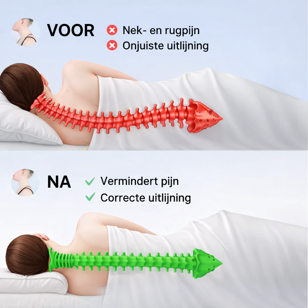 ErgoKussen – Ergonomisch Slaapkussen met Nekondersteuning