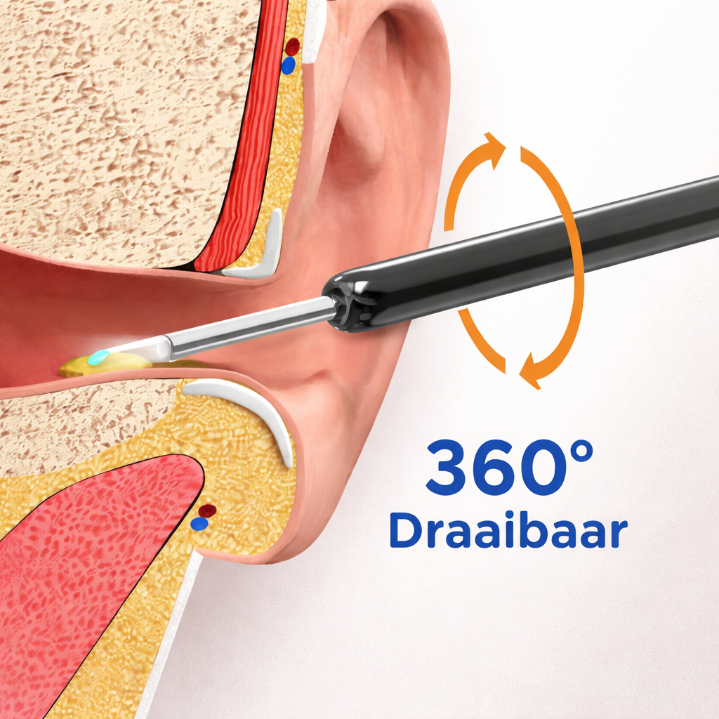 OorScope Pro