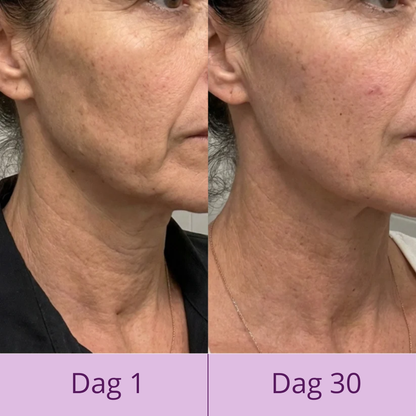 Luméa Lift - 7-in-1 huidverzorgingsapparaat